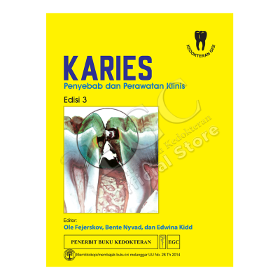 Karies Penyebab dan Perawatan Klinis (Dental Caries: The Disease and Its Clinical Management) Edisi 3