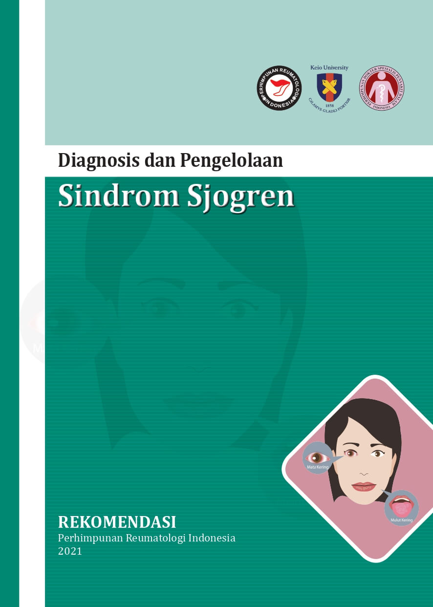 Diagnosis dan Pengelolaan Sindrom Sjogren