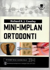 Mini-implan ortodonti=The Orthodontics Mini-Implants Clinical Handbook